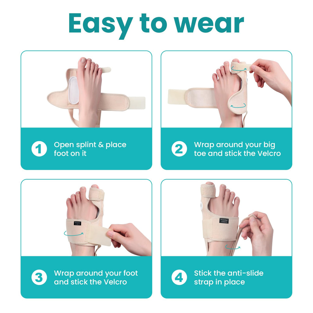 Promifun Bunion Corrector Adjustable Toe Splint Pain Relief Beige 1Pair One Size