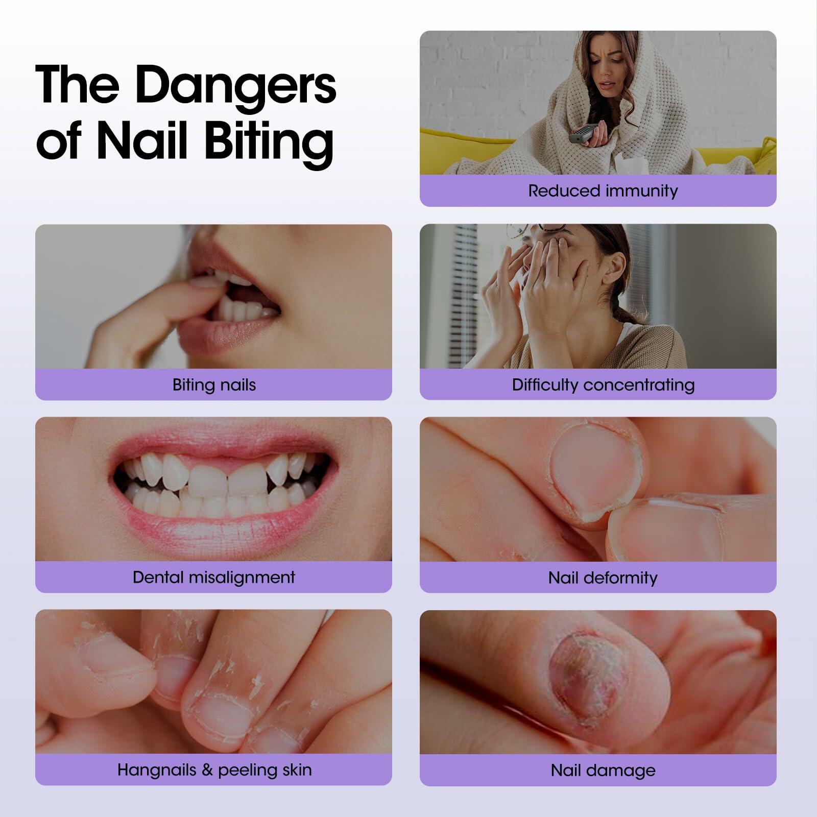 GELLEN Nail Biting Prevention Roll-On Treatment Bitter Taste 10ml